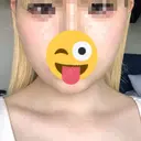 糸リフト / 脂肪吸引（顔） / ボトックス（エラ・小顔） PRISM Beauty Clinic 町田院 AFTER サムネイル用