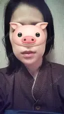 ハイフ（顔） CLASSY 仙台美容外科・美容皮膚科 DAY 12 サムネイル用
