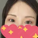 二重埋没 / 眼瞼下垂（非切開） OMI CLINIC 【オミクリニック】 AFTER サムネイル用