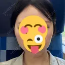 脂肪吸引（顔） / ボトックス（エラ・小顔） WOM CLINIC GINZA （ワム クリニック ギンザ） AFTER サムネイル用