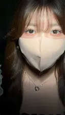 二重埋没 アリエル美容クリニック 大宮院 AFTER サムネイル用