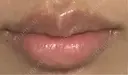 ヒアルロン酸注入（唇） 麻布十番クレールデンタルクリニック AFTER サムネイル用