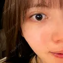 二重埋没 水の森美容クリニック 横浜院 AFTER サムネイル用
