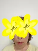 糸リフト / その他（輪郭） アリエル美容クリニック 水戸院 AFTER サムネイル用