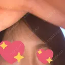 ヒアルロン酸注入（鼻） 広島プルミエクリニック DAY 0 サムネイル用