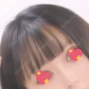 ヒアルロン酸注入（鼻） 広島プルミエクリニック AFTER サムネイル用