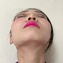 鼻尖形成（切開） / 小鼻縮小（切開） / 軟骨移植 / 鼻尖縮小 / 鼻孔縁下降 アリエル美容クリニック 郡山院 DAY 62 サムネイル用
