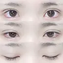 二重埋没 湘南美容クリニック 長野院 DAY 28 サムネイル用