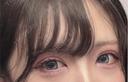 二重埋没 NARU Beauty Clinic 【ナルクリ】 DAY 6 サムネイル用