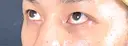 クマ治療 藤・ナチュレ美容クリニック 銀座院 DAY 30 サムネイル用