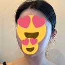 ヒアルロン酸注入（頬） / ヒアルロン酸注入（こめかみ） フィラークリニック 錦糸町院 DAY 1 サムネイル用