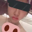 バッカルファット除去 / 脂肪吸引（顔） / ヒアルロン酸注入（あご） / ボトックス（エラ・小顔） / ボトックス（ふくらはぎ） / ボトックス（肩） エートップ美容整形外科 DAY 1 サムネイル用