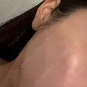 ルメッカ ゼノクリニック DAY 1 サムネイル用