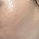 ルメッカ ゼノクリニック DAY 2 サムネイル用