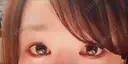 目尻切開 / タレ目形成・グラマラスライン（切開） シエルクリニック DAY 17 サムネイル用