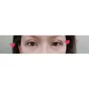 二重切開 / 目頭切開 / 上まぶたの脂肪取り / 蒙古ひだ形成 FROM B整形外科 (旧バウム整形外科) DAY 9 サムネイル用