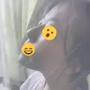 バッカルファット除去 / 脂肪吸引（顔） / ヒアルロン酸注入（あご） / ボトックス（エラ・小顔） / ボトックス（ふくらはぎ） / ボトックス（肩） エートップ美容整形外科 DAY 2 サムネイル用