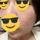 ルメッカ / インモード NYAN CLINIC DAY 6 サムネイル用