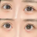 ヒアルロン酸注入（涙袋） HAAB×DREAM BEAUTY CLINIC 東京本院 DAY 14 サムネイル用