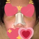 隆鼻術 / 鼻尖形成（切開） / 軟骨移植 / 骨切幅寄せ / ワシ鼻修正・ハンプ切除 / 斜鼻修正 / 鼻修正 韓国BBクリニック（旧 シンミアン形成外科） DAY 4 サムネイル用