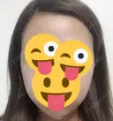 バッカルファット除去 / 脂肪吸引（顔） / ヒアルロン酸注入（あご） / ボトックス（エラ・小顔） エートップ美容整形外科 DAY 2 サムネイル用