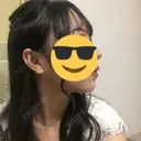 バッカルファット除去 / 脂肪吸引（顔） / ボトックス（エラ・小顔） / ヒアルロン酸注入（額） エートップ美容整形外科 DAY 117 サムネイル用