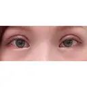 二重切開 / 目頭切開 / 上まぶたの脂肪取り / 蒙古ひだ形成 FROM B整形外科 (旧バウム整形外科) DAY 21 サムネイル用