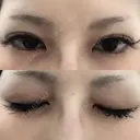 二重埋没 / クマ治療 / ボトックス（エラ・小顔） 湘南美容クリニック 川崎院 AFTER サムネイル用