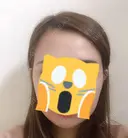 バッカルファット除去 / 脂肪吸引（顔） / ヒアルロン酸注入（あご） / ボトックス（エラ・小顔） エートップ美容整形外科 DAY 8 サムネイル用