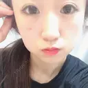 下まぶたの脂肪取り 表参道スキンクリニック 表参道院 DAY 10 サムネイル用