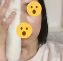 骨削り（頬） / 輪郭修正 マックスファクス銀座クリニック DAY 8 サムネイル用