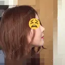 あごプロテーゼ / その他（輪郭） / セットバック / その他（審美歯科/矯正歯科） 大塚美容形成外科・歯科 大塚本院 DAY 184 サムネイル用