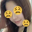 あごプロテーゼ / その他（輪郭） / セットバック / その他（審美歯科/矯正歯科） 大塚美容形成外科・歯科 大塚本院 DAY 184 サムネイル用
