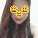 あごプロテーゼ / その他（輪郭） / セットバック / その他（審美歯科/矯正歯科） 大塚美容形成外科・歯科 大塚本院 DAY 184 サムネイル用