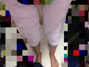 脂肪吸引（脚） / 脂肪吸引（お尻） ガーデンクリニック 大阪院 AFTER サムネイル用