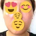脂肪溶解注射（顔） 聖心美容クリニック 広島院 AFTER サムネイル用