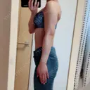 脂肪溶解注射（二の腕） 明洞トックスエンフィル DAY 8 サムネイル用