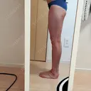 脂肪溶解注射 明洞トックスエンフィル DAY 8 サムネイル用