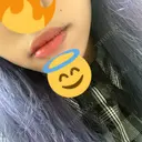 口唇縮小術 / PRP皮膚再生療法 品川スキンクリニック福岡院 DAY 8 サムネイル用