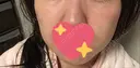イオン導入 / 美肌レーザー / フォトRF / ニキビ治療 サッポロファクトリー 皮膚科・スキンケアクリニック DAY 7 サムネイル用