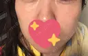 イオン導入 / 美肌レーザー / フォトRF / ニキビ治療 サッポロファクトリー 皮膚科・スキンケアクリニック DAY 92 サムネイル用