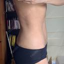 脂肪吸引（お腹） 聖心美容クリニック 札幌院 DAY 240 サムネイル用