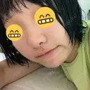 小鼻縮小（切開） / 軟骨移植 / 斜鼻修正 キップン整形外科 DAY 12 サムネイル用