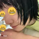 小鼻縮小（切開） / 軟骨移植 / 斜鼻修正 キップン整形外科 DAY 12 サムネイル用