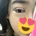 二重埋没 / 眼瞼下垂（切開） / 目尻切開 / 蒙古ひだ形成 / タレ目形成・グラマラスライン（切開） POP美容整形クリニック DAY 0 サムネイル用