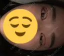 二重埋没 / 眼瞼下垂（切開） / 目尻切開 / 蒙古ひだ形成 / タレ目形成・グラマラスライン（切開） POP美容整形クリニック DAY 0 サムネイル用
