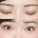 二重埋没 湘南美容クリニック 松山院 DAY 0 サムネイル用