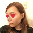 糸リフト / ヒアルロン酸注入（あご） / ボトックス（エラ・小顔） / 脂肪溶解注射（顔） 品川スキンクリニック熊本院 DAY 2 サムネイル用