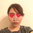 糸リフト / ヒアルロン酸注入（あご） / ボトックス（エラ・小顔） / 脂肪溶解注射（顔） 品川スキンクリニック熊本院 AFTER サムネイル用