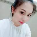 二重埋没 / 目頭切開 / 鼻尖形成（切開） / 鼻中隔延長（切開） / 軟骨移植 / ヒアルロン酸注入（鼻） / ヒアルロン酸注入（あご） 湘南美容クリニック 新潟院 DAY 32 サムネイル用